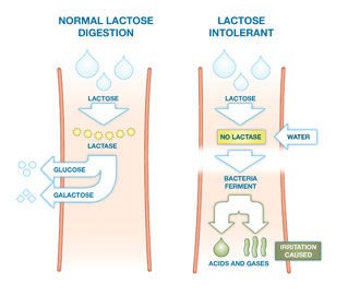 lactose_intolerance_diagram